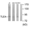 Western blot analysis of extracts from Jurkat cells, 293 cells and HuvEc cells, using TLE4 antibody.