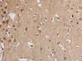 The image on the left is immunohistochemistry of paraffin-embedded Human brain tissue using CSB-PA934646(ELOVL1 Antibody) at dilution 1/30, on the right is treated with fusion protein. (Original magnification: ×200)