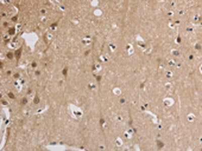 The image on the left is immunohistochemistry of paraffin-embedded Human brain tissue using CSB-PA934646(ELOVL1 Antibody) at dilution 1/30, on the right is treated with fusion protein. (Original magnification: ×200)