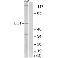 Western blot analysis of extracts from K562 cells, using DCT antibody.