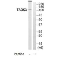 Western blot analysis of extracts from K562 cells, using TAOK3 antibody.