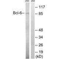 Western blot analysis of extracts from 293 cells, using Bcl-6 (Ab-333) antibody.