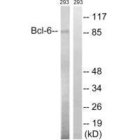 Western blot analysis of extracts from 293 cells, using Bcl-6 (Ab-333) antibody.