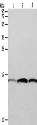 Gel: 12%SDS-PAGE, Lysate: 40 ug, Lane 1-3: Hela cells, HT29 cells, A549 cells, Primary antibody: CSB-PA935634(PFN1 Antibody) at dilution 1/200, Secondary antibody: Goat anti rabbit IgG at 1/8000 dilution, Exposure time: 10 seconds