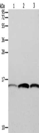 Gel: 12%SDS-PAGE, Lysate: 40 ug, Lane 1-3: Hela cells, HT29 cells, A549 cells, Primary antibody: CSB-PA935634(PFN1 Antibody) at dilution 1/200, Secondary antibody: Goat anti rabbit IgG at 1/8000 dilution, Exposure time: 10 seconds