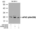 Western blot analysis of extracts from SK-BR-3 cells, untreated or  insulin and EGF treated, and pretreated with U0126 cells, using eIF4E (Phospho-Ser209) Antibody.