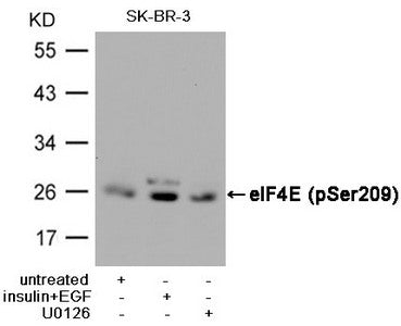 Western blot analysis of extracts from SK-BR-3 cells, untreated or  insulin and EGF treated, and pretreated with U0126 cells, using eIF4E (Phospho-Ser209) Antibody.