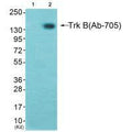 Western blot analysis of extracts from K562 cells (Lane 2), using Trk B (Ab-705) antiobdy. The lane on the left is treated with synthesized peptide.