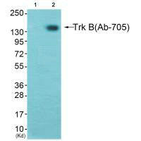 Western blot analysis of extracts from K562 cells (Lane 2), using Trk B (Ab-705) antiobdy. The lane on the left is treated with synthesized peptide.