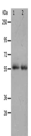 Gel: 10+12%SDS-PAGE, Lysate: 40 ug, Lane 1-2: K562 cells, human colon cancer tissue, Primary antibody: CSB-PA936376(MMP17 Antibody) at dilution 1/900, Secondary antibody: Goat anti rabbit IgG at 1/8000 dilution, Exposure time: 2 minutes