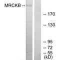 Western blot analysis of extracts from COLO cells, using MRCKB antibody.