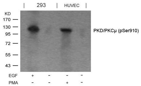 Western blot analysis of extracts from EGF-treated 293 and PMA-treated HUVEC cells using PKD/PKCm(Phospho-Ser910) Antibody.