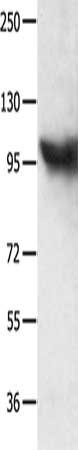Gel: 10%SDS-PAGE, Lysate: 40 ug, Lane: Jurkat cells, Primary antibody: CSB-PA936890(MCM8 Antibody) at dilution 1/300, Secondary antibody: Goat anti rabbit IgG at 1/8000 dilution, Exposure time: 1 minute