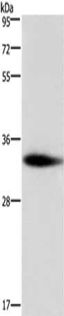 Gel: 8%SDS-PAGE,Lysate: 40 ug,,Primary antibody: CSB-PA937425(ADO Antibody) at dilution 1/300 dilution,Secondary antibody: Goat anti rabbit IgG at 1/8000 dilution,Exposure time: 5 minutes