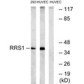 Western blot analysis of extracts from 293 cells and HuvEc cells, using RRS1 antibody.