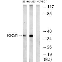 Western blot analysis of extracts from 293 cells and HuvEc cells, using RRS1 antibody.