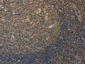 The image on the left is immunohistochemistry of paraffin-embedded Human tonsil tissue using CSB-PA938110(DDX19B Antibody) at dilution 1/20, on the right is treated with fusion protein. (Original magnification: ×200)
