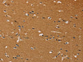 The image on the left is immunohistochemistry of paraffin-embedded Human brain tissue using CSB-PA938221(CHRNA4 Antibody) at dilution 1/40, on the right is treated with fusion protein. (Original magnification: ×200)