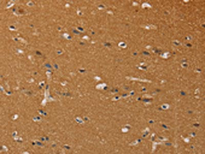 The image on the left is immunohistochemistry of paraffin-embedded Human brain tissue using CSB-PA938221(CHRNA4 Antibody) at dilution 1/40, on the right is treated with fusion protein. (Original magnification: ×200)