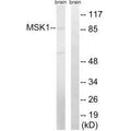 Western blot analysis of extracts from mouse brain cells, using MSK1 (Ab-212) antibody.