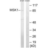 Western blot analysis of extracts from mouse brain cells, using MSK1 (Ab-212) antibody.