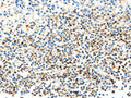The image on the left is immunohistochemistry of paraffin-embedded Human tonsil tissue using CSB-PA938413(FAM3A Antibody) at dilution 1/25, on the right is treated with fusion protein. (Original magnification: ×200)