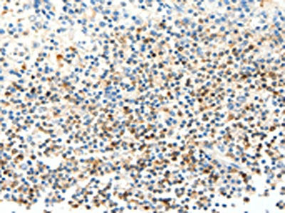 The image on the left is immunohistochemistry of paraffin-embedded Human tonsil tissue using CSB-PA938413(FAM3A Antibody) at dilution 1/25, on the right is treated with fusion protein. (Original magnification: ×200)