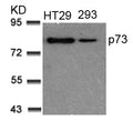 Western blot analysis of extracts from HT29 and 293 cells using p73(Ab-99) Antibody.