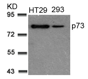 Western blot analysis of extracts from HT29 and 293 cells using p73(Ab-99) Antibody.