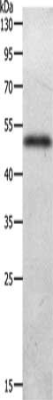 Gel: 10%SDS-PAGE, Lysate: 40 ug, Lane: Human liver cancer tissue, Primary antibody: CSB-PA938581(ADIPOQ Antibody) at dilution 1/300, Secondary antibody: Goat anti rabbit IgG at 1/8000 dilution, Exposure time: 2 minutes