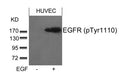 Western blot analysis of extracts from HUVEC cells untreated or treated with EGF using EGFR(phospho-Tyr1110) Antibody.