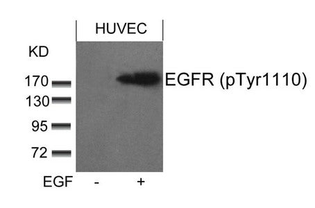 Western blot analysis of extracts from HUVEC cells untreated or treated with EGF using EGFR(phospho-Tyr1110) Antibody.