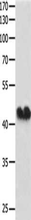 Gel: 10%SDS-PAGE, Lysate: 40 ug, Lane: Hela cells, Primary antibody: CSB-PA938769(GJA1 Antibody) at dilution 1/250, Secondary antibody: Goat anti rabbit IgG at 1/8000 dilution, Exposure time: 30 minutes