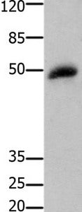 Gel: 10%SDS-PAGE Lysates (from left to right): Human small intestine stromal cancer tissue Amount of lysate: 30ug per lane Primary antibody: 1/100 dilution Secondary antibody dilution: 1/8000 Exposure time: 5 minutes