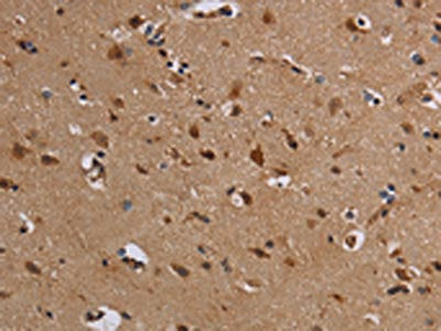 The image on the left is immunohistochemistry of paraffin-embedded Human brain tissue using CSB-PA940234(KCNK13 Antibody) at dilution 1/50, on the right is treated with fusion protein. (Original magnification: ×200)