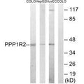 Western blot analysis of extracts from COLO cells, HepG2 cells and HUVEC cells, using PPP1R2 (Ab-44) antibody.