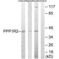 Western blot analysis of extracts from COLO cells, HepG2 cells and HUVEC cells, using PPP1R2 (Ab-44) antibody.
