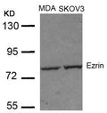 Western blot analysis of extracts from MDA and SKOV3 cells using Ezrin(Ab-353) Antibody.