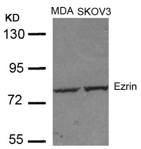 Western blot analysis of extracts from MDA and SKOV3 cells using Ezrin(Ab-353) Antibody.