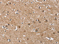 The image on the left is immunohistochemistry of paraffin-embedded Human brain tissue using CSB-PA941013(BUB1 Antibody) at dilution 1/60, on the right is treated with fusion protein. (Original magnification: ×200)