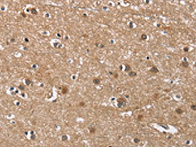 The image on the left is immunohistochemistry of paraffin-embedded Human brain tissue using CSB-PA941013(BUB1 Antibody) at dilution 1/60, on the right is treated with fusion protein. (Original magnification: ×200)