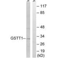 Western blot analysis of extracts from Jurkat cells, using GSTT1/4 antibody.