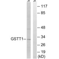 Western blot analysis of extracts from Jurkat cells, using GSTT1/4 antibody.