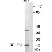 Western blot analysis of extracts from COLO cells, using RPL27A antibody.