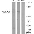 Western blot analysis of extracts from Jurkat cells and K562 cells, using ADCK2 antibody.