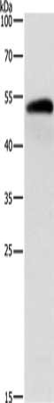 Gel: 10%SDS-PAGE, Lysate: 40 ug, Lane: Human liver cancer tissue, Primary antibody: CSB-PA942262(ALDH1B1 Antibody) at dilution 1/900, Secondary antibody: Goat anti rabbit IgG at 1/8000 dilution, Exposure time: 50 seconds