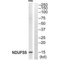 Western blot analysis of extracts from K562 cells, using NDUFS5 antiobdy.