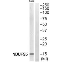 Western blot analysis of extracts from K562 cells, using NDUFS5 antiobdy.