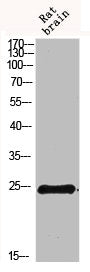 Western blot analysis of 293T Hela VEC KB mouse-kidney lysate, antibody was diluted at 500. Secondary antibody  was diluted at 1:20000
