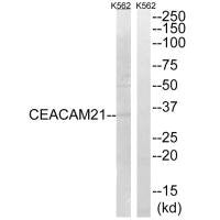 Western blot analysis of extracts from K562 cells, using CEACAM21 antibody.